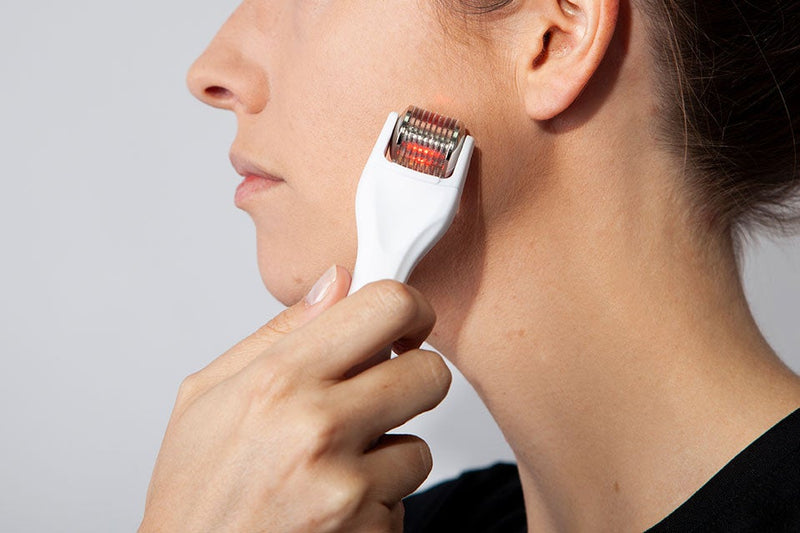 5 reasons you should try microneedling