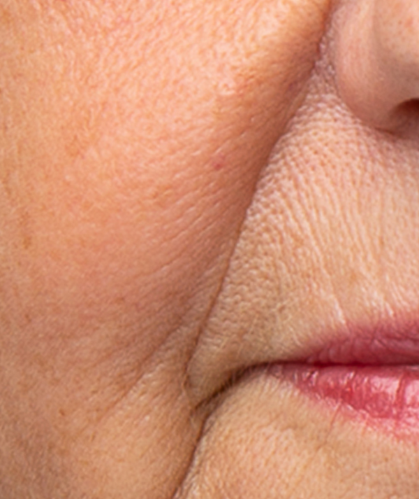 Anti-Ageing